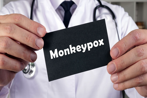 Strep xét nghiệm phát hiện kháng nguyên nhanh: Năm điều bạn cần biết về Monkeypox